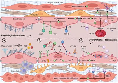 Endothelial dysfunction in preterm infants: The hidden legacy of uteroplacental pathologies